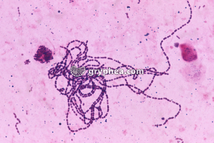 Streptocoques x400 - gryphea.com